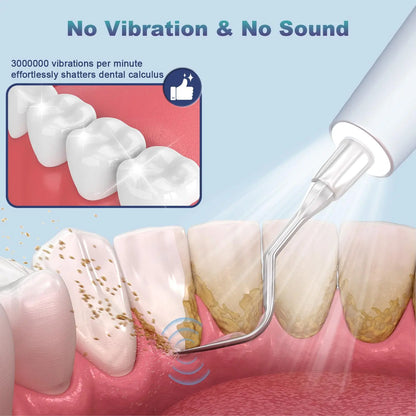 Ultrasonic Dental Plaque Remover