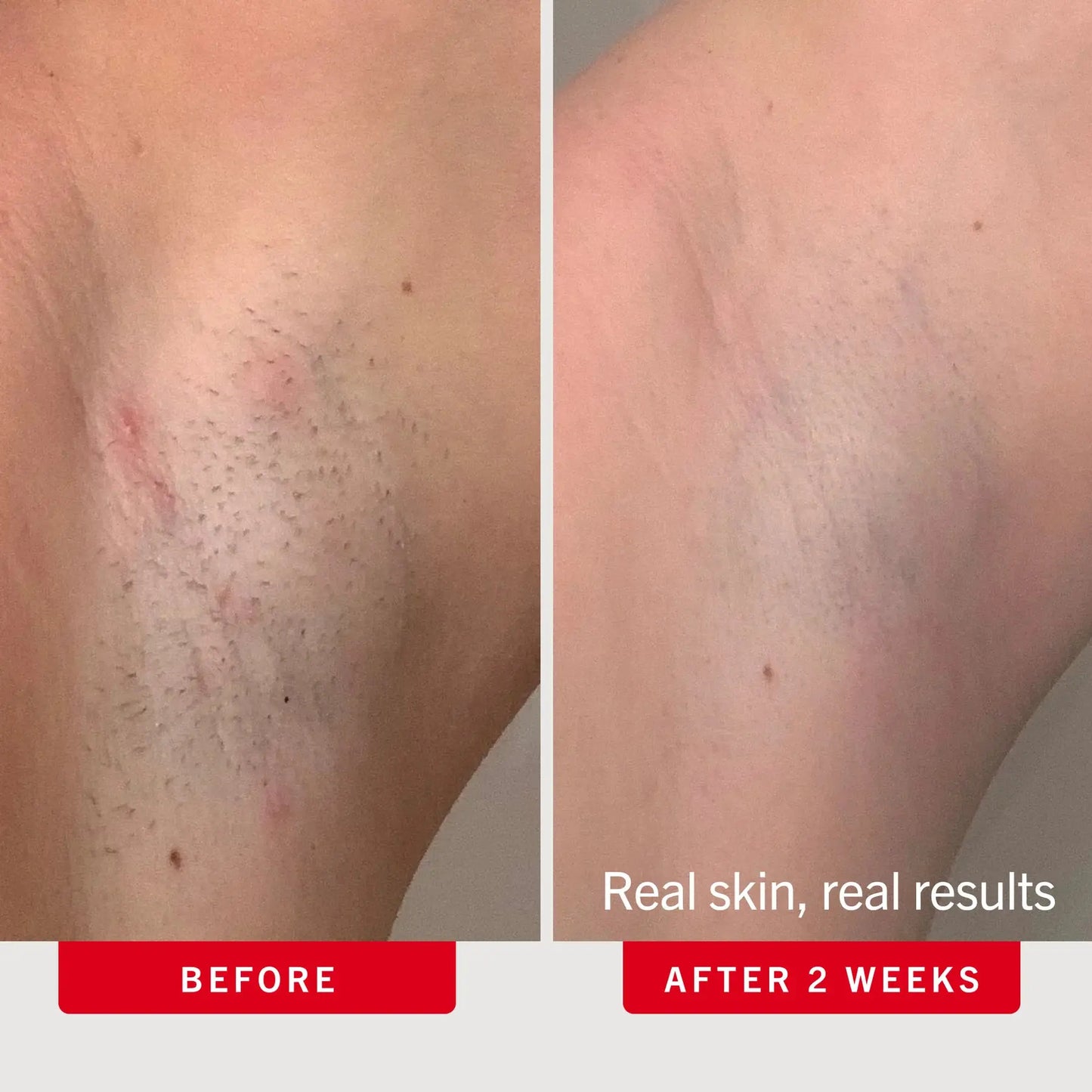 Ingrown Bump-Smoothing Duo
