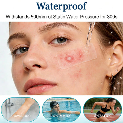 Medical-Grade Hydrocolloid Roll