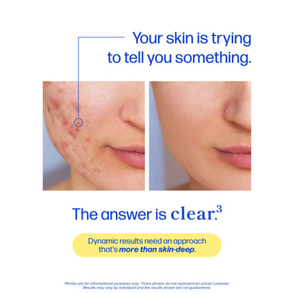 Clear³ Skin Acne Supplement with Zinc, DIM & Probiotics | 3-in-1 Balance, Clarify, Restore Support with Hyaluronic Acid & Skin Support Vitamins