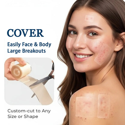 Medical-Grade Hydrocolloid Roll