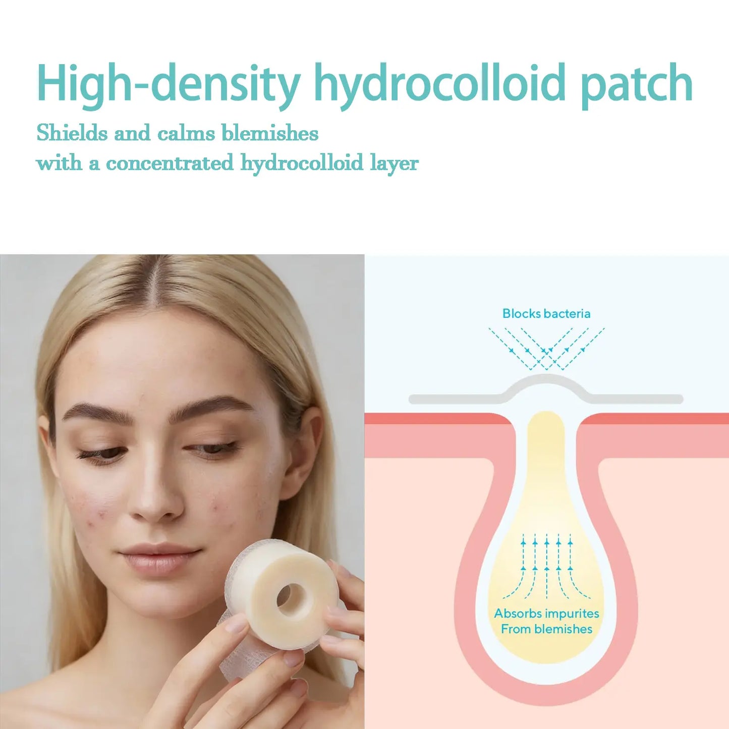 Medical-Grade Hydrocolloid Roll